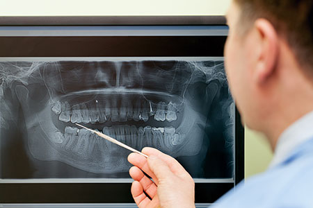 person looking at dental xray